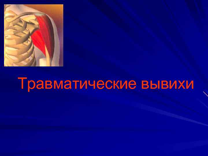 Травматические вывихи 