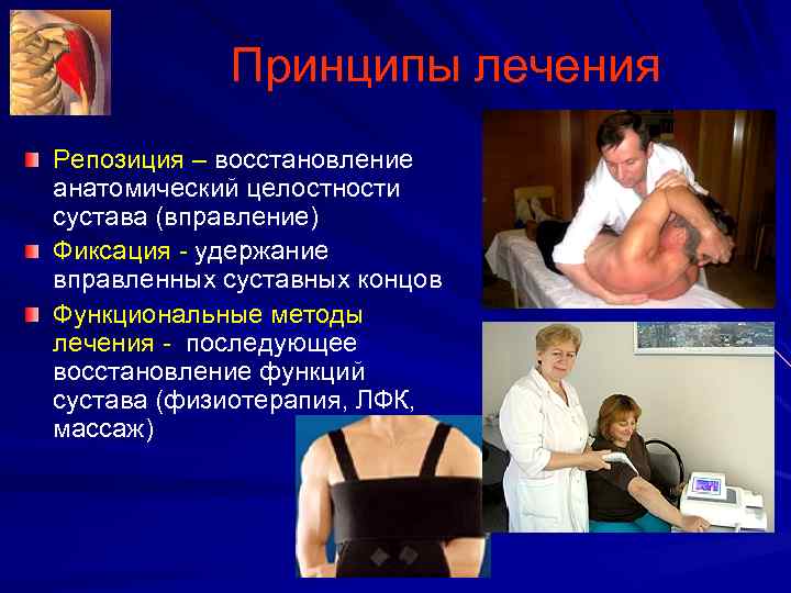 Принципы лечения Репозиция – восстановление анатомический целостности сустава (вправление) Фиксация удержание вправленных суставных концов