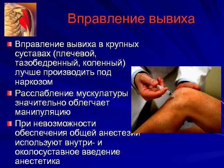 Вправление вывиха в крупных суставах (плечевой, тазобедренный, коленный) лучше производить под наркозом Расслабление мускулатуры