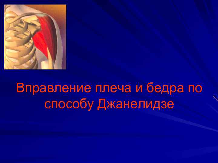 Вправление плеча и бедра по способу Джанелидзе 