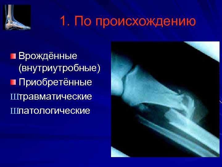 1. По происхождению Врождённые (внутриутробные) Приобретённые Штравматические Шпатологические 