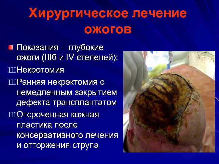 Хирургическое лечение ожогов Показания - глубокие ожоги (IIIб и IV степеней): Ш Некротомия Ш