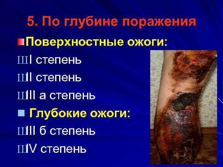 5. По глубине поражения Поверхностные ожоги: Ш I степень Ш степень II Ш a