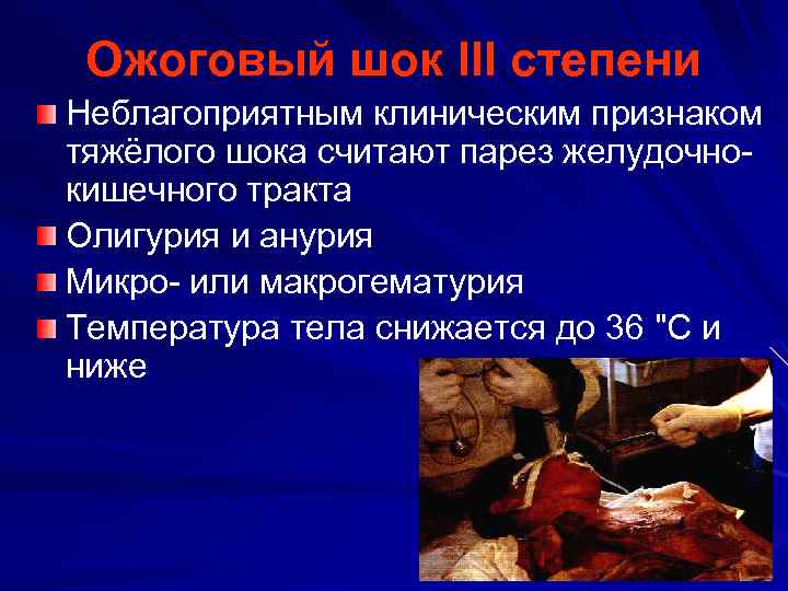 Ожоговый шок III степени Неблагоприятным клиническим признаком тяжёлого шока считают парез желудочнокишечного тракта Олигурия