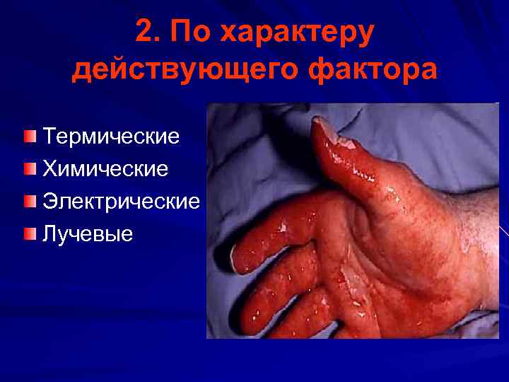 2. По характеру действующего фактора Термические Химические Электрические Лучевые 