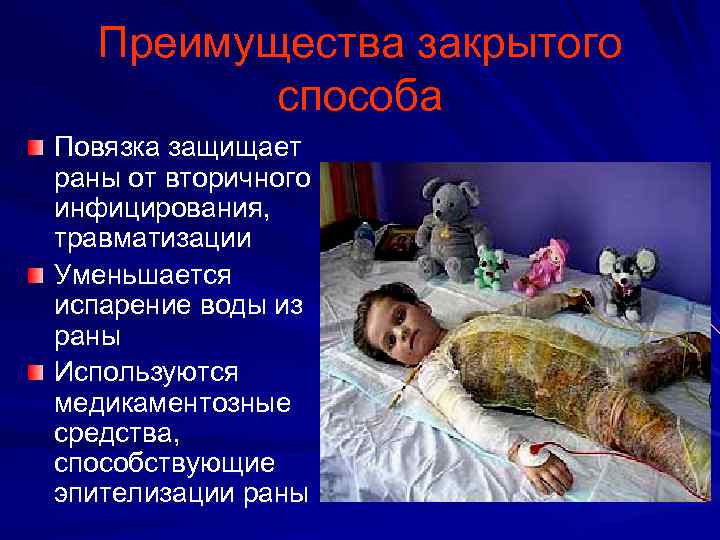 Преимущества закрытого способа Повязка защищает раны от вторичного инфицирования, травматизации Уменьшается испарение воды из