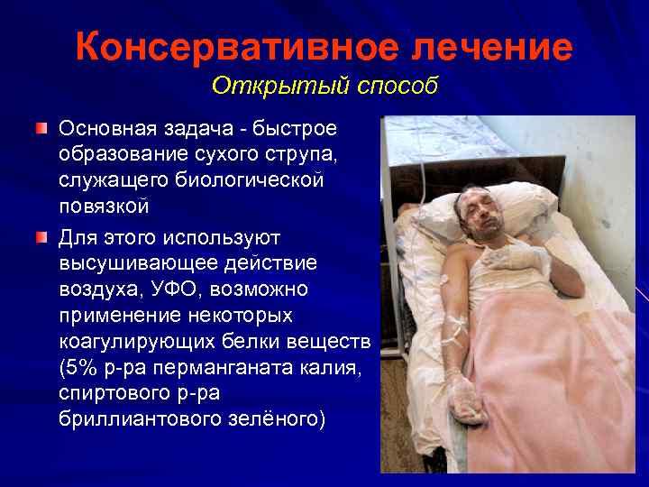 Консервативное лечение Открытый способ Основная задача - быстрое образование сухого струпа, служащего биологической повязкой