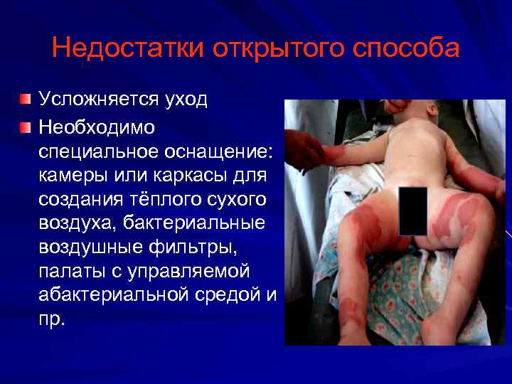 Недостатки открытого способа Усложняется уход Необходимо специальное оснащение: камеры или каркасы для создания тёплого