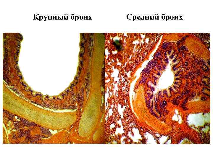 Крупный бронх Средний бронх 