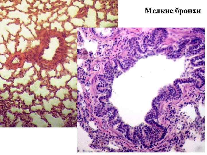 Мелкие бронхи 