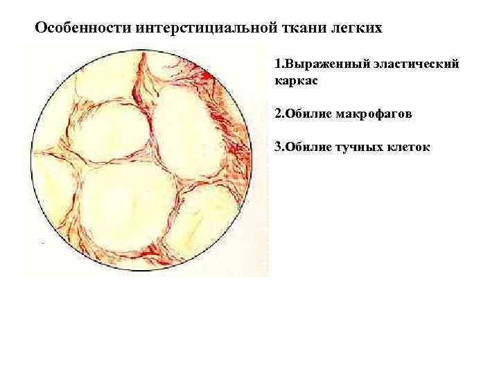 Особенности интерстициальной ткани легких 1. Выраженный эластический каркас 2. Обилие макрофагов 3. Обилие тучных