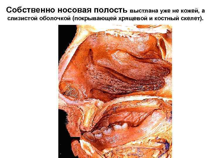 Собственно носовая полость выстлана уже не кожей, а слизистой оболочкой (покрывающей хрящевой и костный