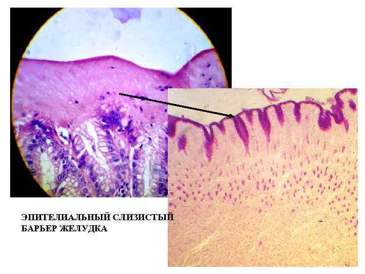 ЭПИТЕЛИАЛЬНЫЙ СЛИЗИСТЫЙ БАРЬЕР ЖЕЛУДКА 