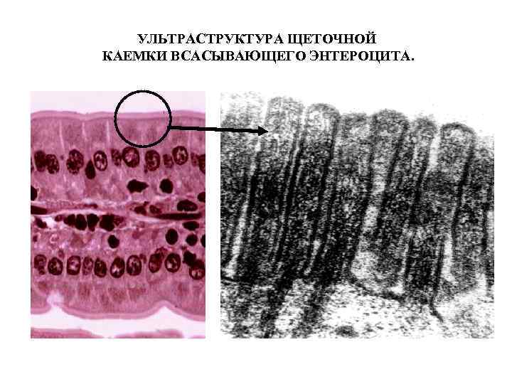 УЛЬТРАСТРУКТУРА ЩЕТОЧНОЙ КАЕМКИ ВСАСЫВАЮЩЕГО ЭНТЕРОЦИТА. 