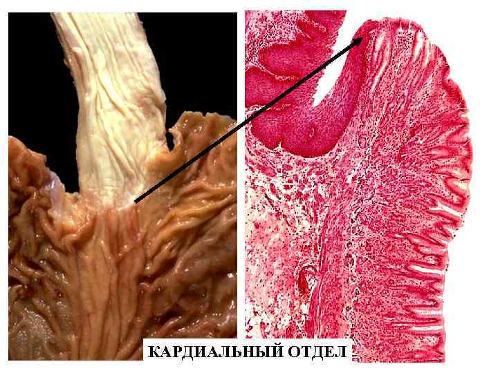 КАРДИАЛЬНЫЙ ОТДЕЛ 
