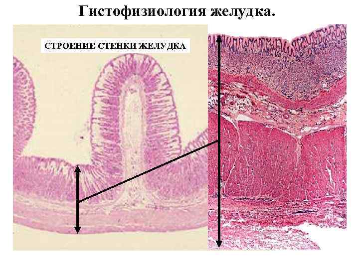 Гистофизиология желудка. СТРОЕНИЕ СТЕНКИ ЖЕЛУДКА 