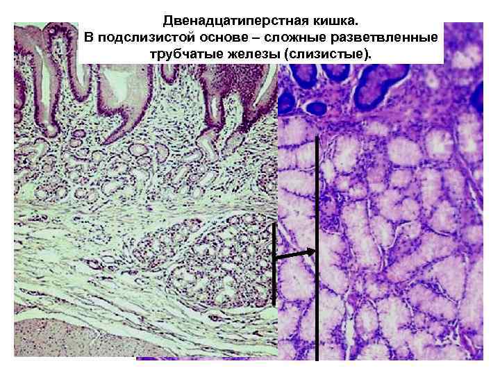 Двенадцатиперстная кишка гистология рисунок