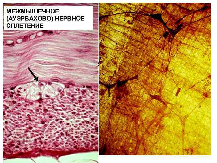 МЕЖМЫШЕЧНОЕ (АУЭРБАХОВО) НЕРВНОЕ СПЛЕТЕНИЕ 