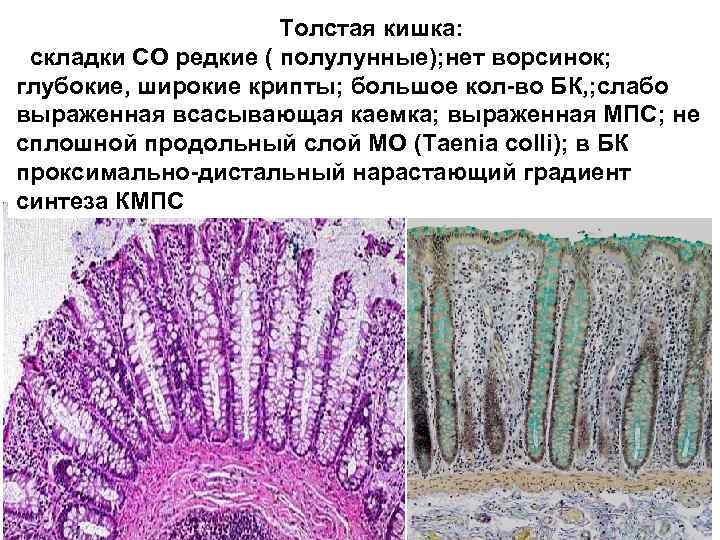 Толстая кишка: складки СО редкие ( полулунные); нет ворсинок; глубокие, широкие крипты; большое кол-во