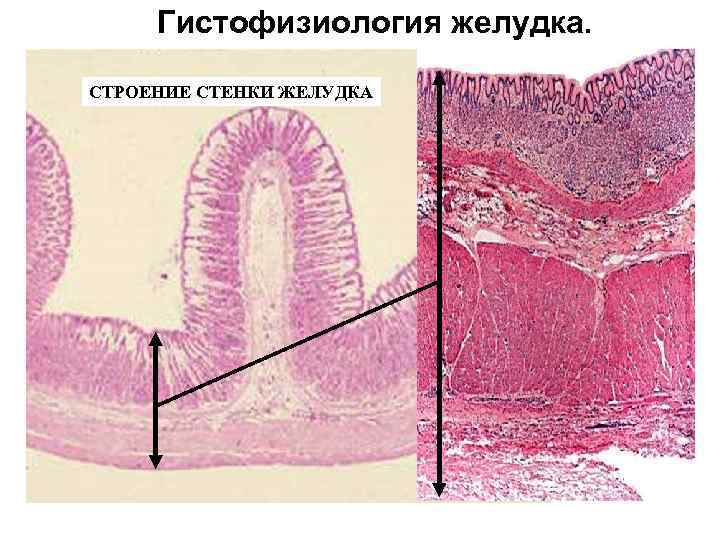 Гистофизиология желудка. СТРОЕНИЕ СТЕНКИ ЖЕЛУДКА 
