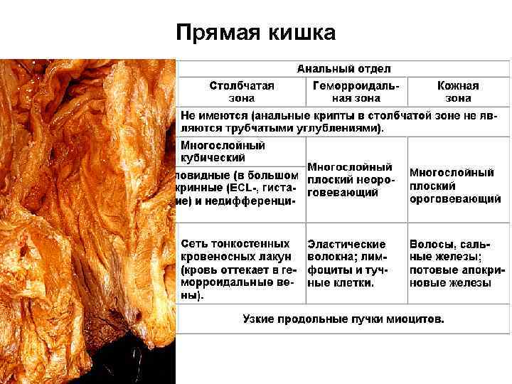 Прямая кишка 