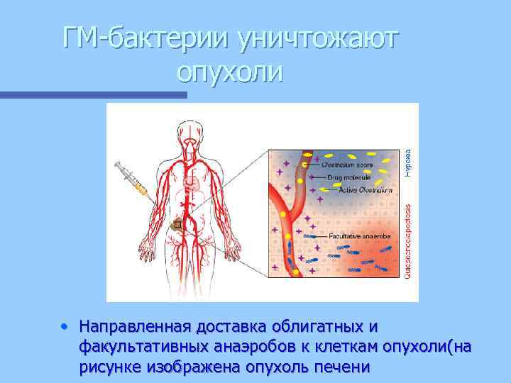 ГМ-бактерии уничтожают опухоли • Направленная доставка облигатных и факультативных анаэробов к клеткам опухоли(на рисунке