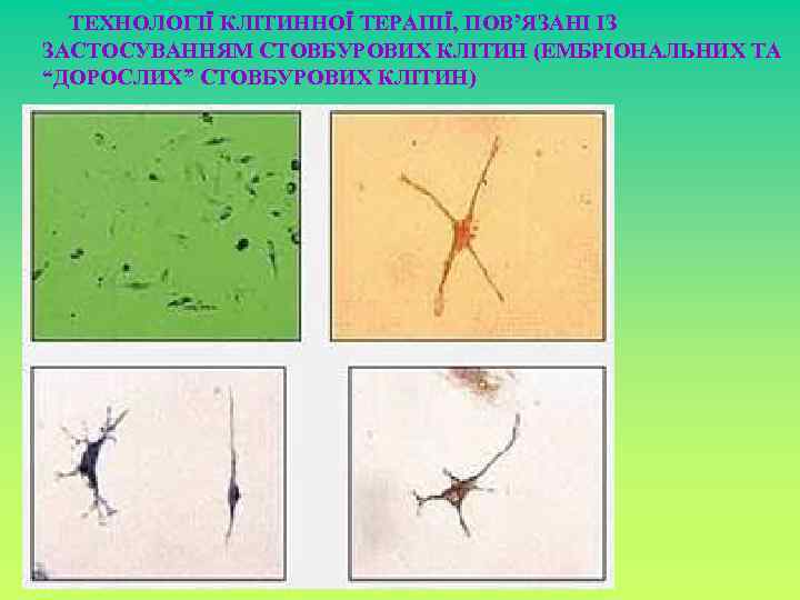 ТЕХНОЛОГІЇ КЛІТИННОЇ ТЕРАПІЇ, ПОВ’ЯЗАНІ ІЗ ЗАСТОСУВАННЯМ СТОВБУРОВИХ КЛІТИН (ЕМБРІОНАЛЬНИХ ТА “ДОРОСЛИХ” СТОВБУРОВИХ КЛІТИН) 