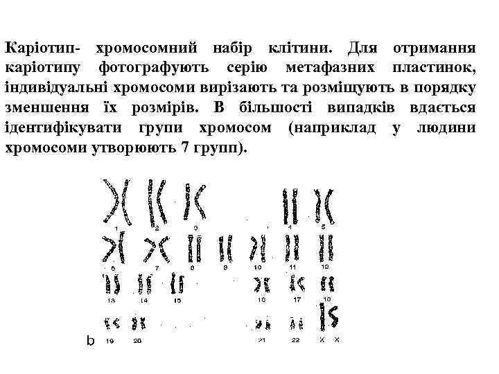 Каріотип- хромосомний набір клітини. Для отримання каріотипу фотографують серію метафазних пластинок, індивідуальні хромосоми