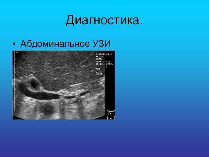 Диагностика. • Абдоминальное УЗИ 