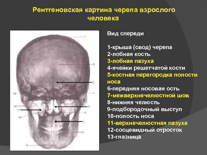 Рентгеновская картина черепа взрослого человека Вид спереди 1 -крыша (свод) черепа 2 -лобная кость