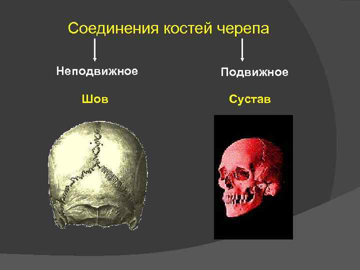 Череп неподвижный. Соединение костей черепа таблица швы. Соединения костей черепа и суставы головы. Неподвижные кости черепа. Неподвижное соединение костей черепа.