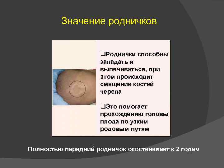 Значение родничков q. Роднички способны западать и выпячиваться, при этом происходит смещение костей черепа