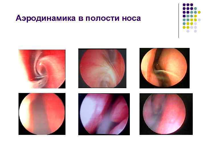 Аэродинамика в полости носа 