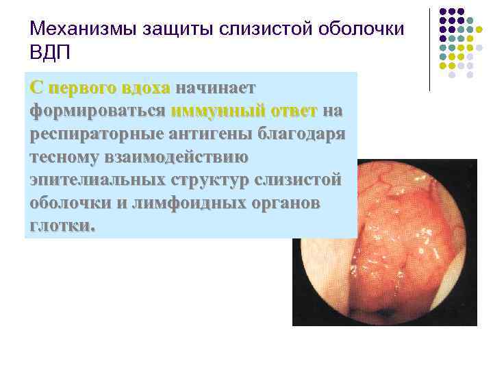 Механизмы защиты слизистой оболочки ВДП С первого вдоха начинает формироваться иммунный ответ на респираторные