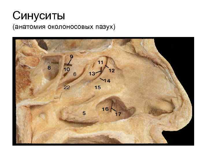 Синуситы (анатомия околоносовых пазух) 