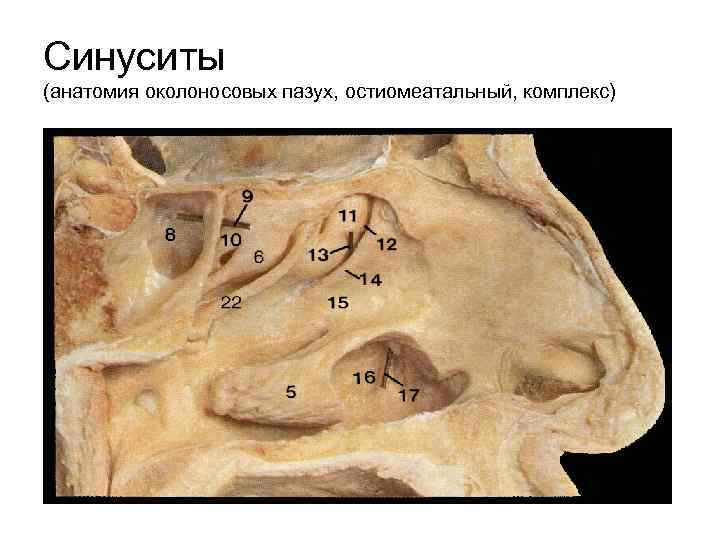 Синуситы (анатомия околоносовых пазух, остиомеатальный, комплекс) 