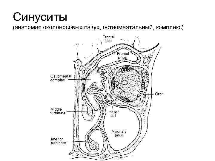 Синуситы (анатомия околоносовых пазух, остиомеатальный, комплекс) 