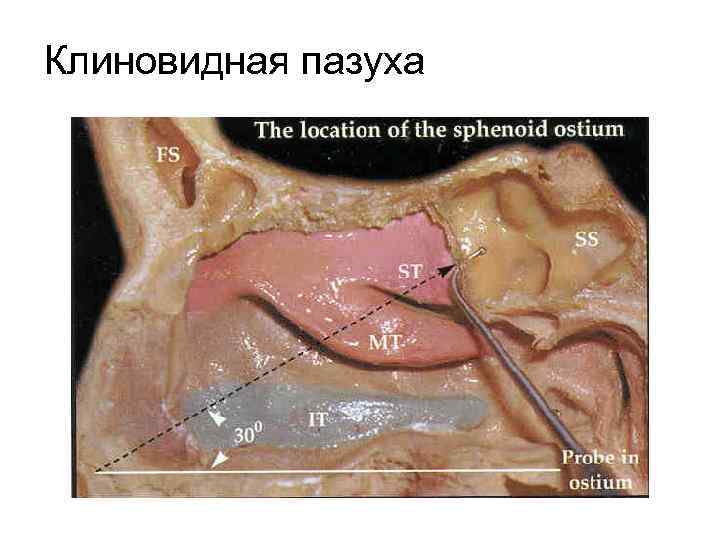 Клиновидная пазуха 