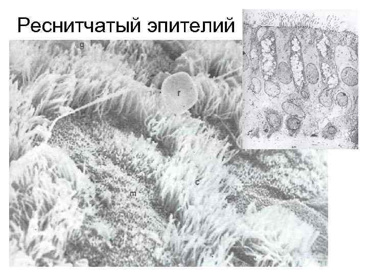 Реснитчатый эпителий 