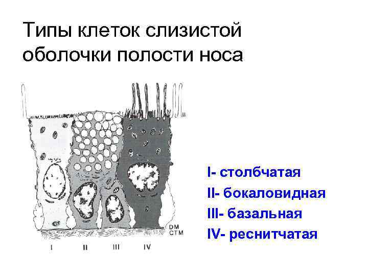 Типы клеток слизистой оболочки полости носа I- столбчатая II- бокаловидная III- базальная IV- реснитчатая