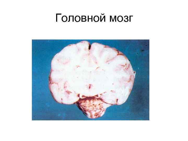 Головной мозг 