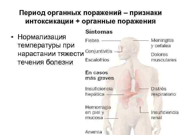 Период органных поражений – признаки интоксикации + органные поражения • Нормализация температуры при нарастании