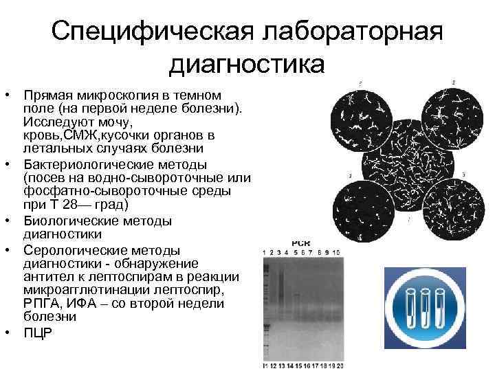 Специфическая лабораторная диагностика • Прямая микроскопия в темном поле (на первой неделе болезни). Исследуют