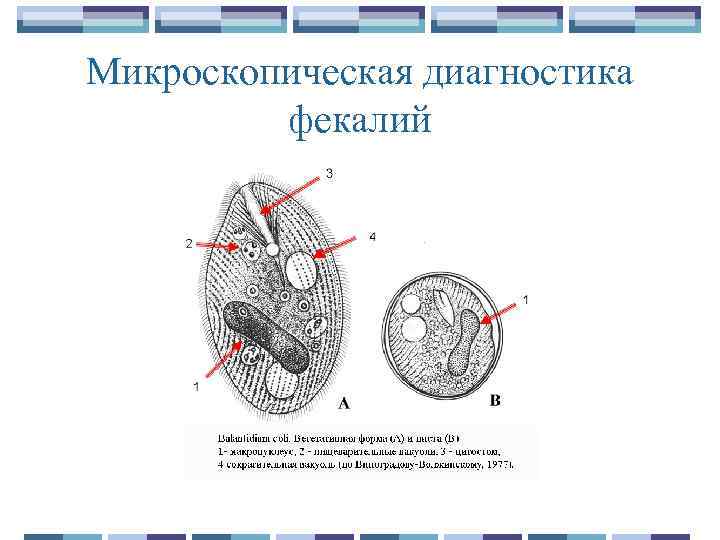 Микроскопическая диагностика фекалий 