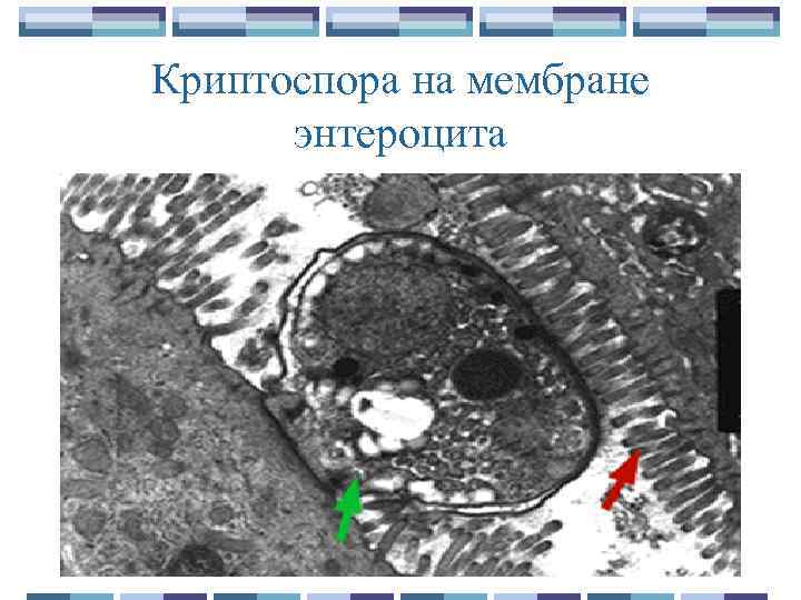 Криптоспора на мембране энтероцита 