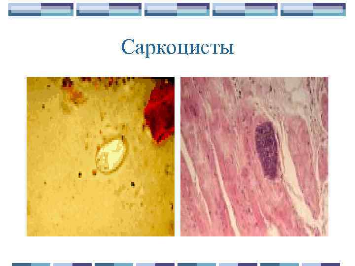 Саркоцисты 