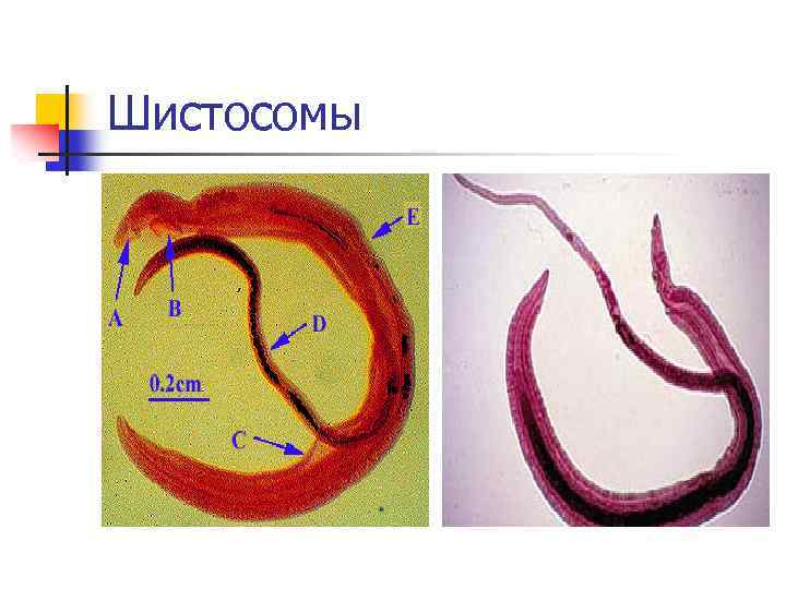 Schistosoma japonicum