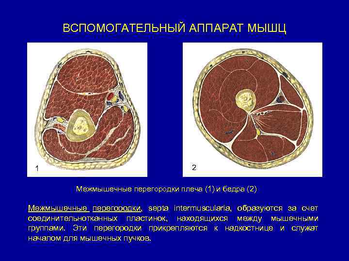 ВСПОМОГАТЕЛЬНЫЙ АППАРАТ МЫШЦ 1 1 2 Межмышечные перегородки плеча (1) и бедра (2) Межмышечные