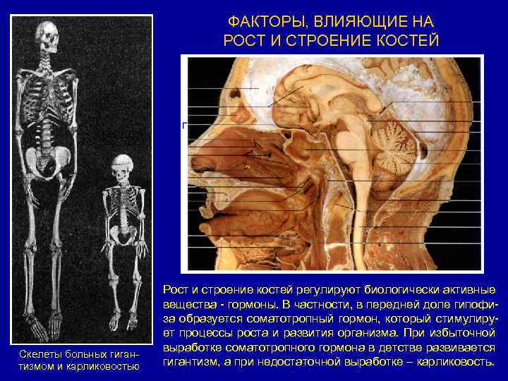 Ткань обеспечивающая рост костей в толщину. Рост костей. Факторы формирования костей анатомия. Факторы влияющие на рост и развитие скелета. Факторы влияющие на рост и развитие костей.