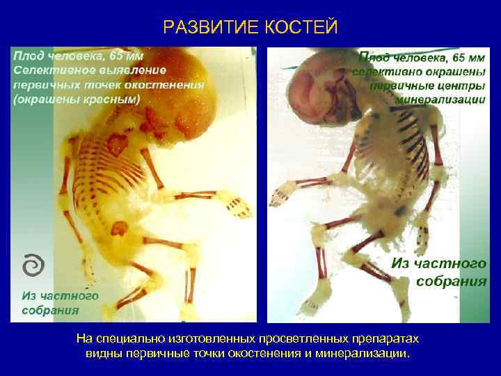 РАЗВИТИЕ КОСТЕЙ На специально изготовленных просветленных препаратах видны первичные точки окостенения и минерализации. 
